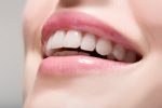 Combat Holiday Dental Stain With These 7 Easy Tips