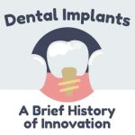 Dental Implants: A Brief History of Tooth Replacement Innovation