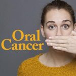Oral Cancer – Protection & Early Detection