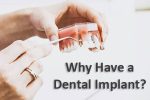 Why Have a Dental Implant?