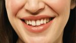 Common Problems Caused by Gapped Teeth