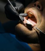 Why it’s Best to Treat Cavities Early